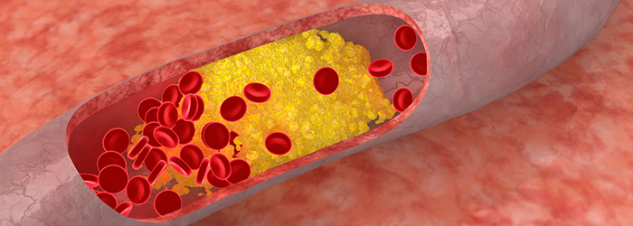 Kolesterol ile ilgili merak edilen 8 soru-cevap - Acıbadem Hayat